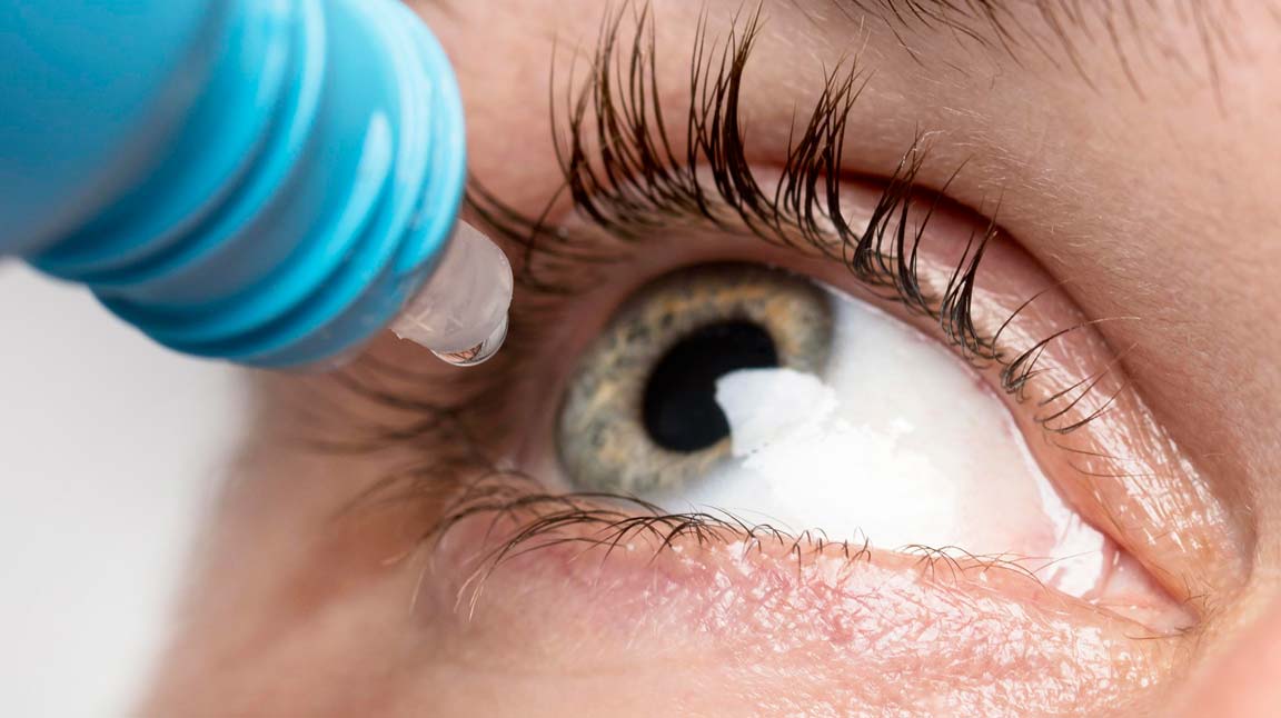 lagrimas artificiales hidratacion ocular conjuntivitis